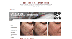 Desktop Screenshot of collageninjectionsnyc.org