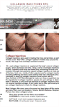 Mobile Screenshot of collageninjectionsnyc.org